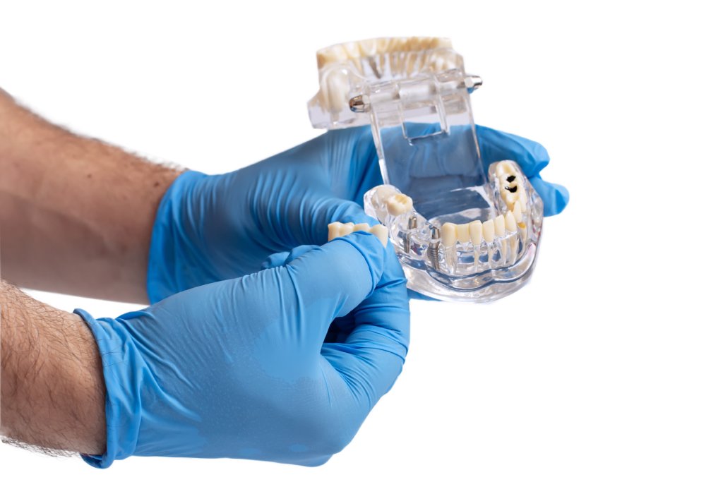 Lawen Dentistry Spring Garden - Dental treatments