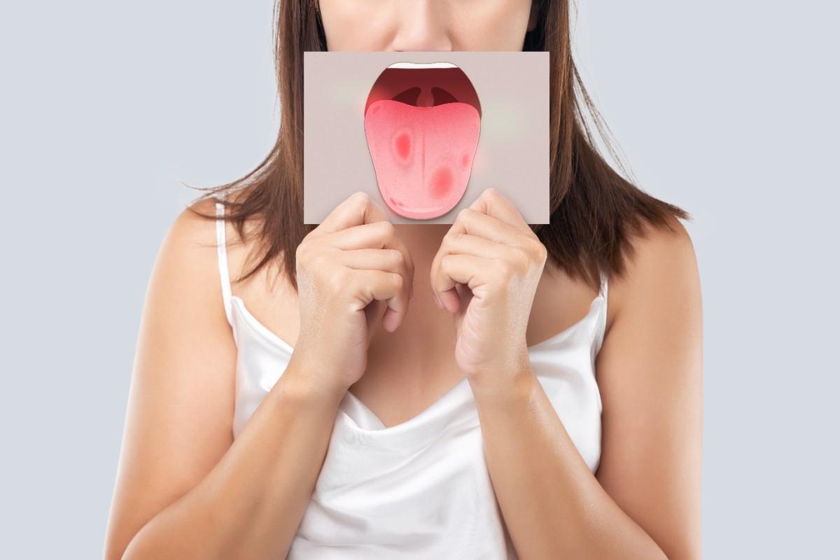 That Painful Spot on Your Tongue: What Your Mouth Is Trying to Tell You
