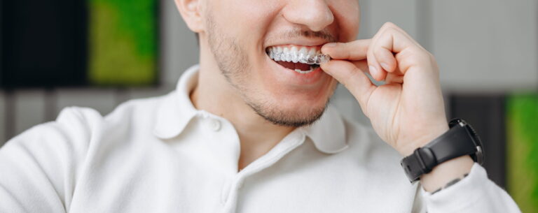 Common Invisalign Mistakes That Slow Down Your Treatment